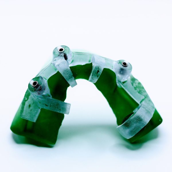 S3 Full Arch - Complete Full Arch Treatment - Image 10