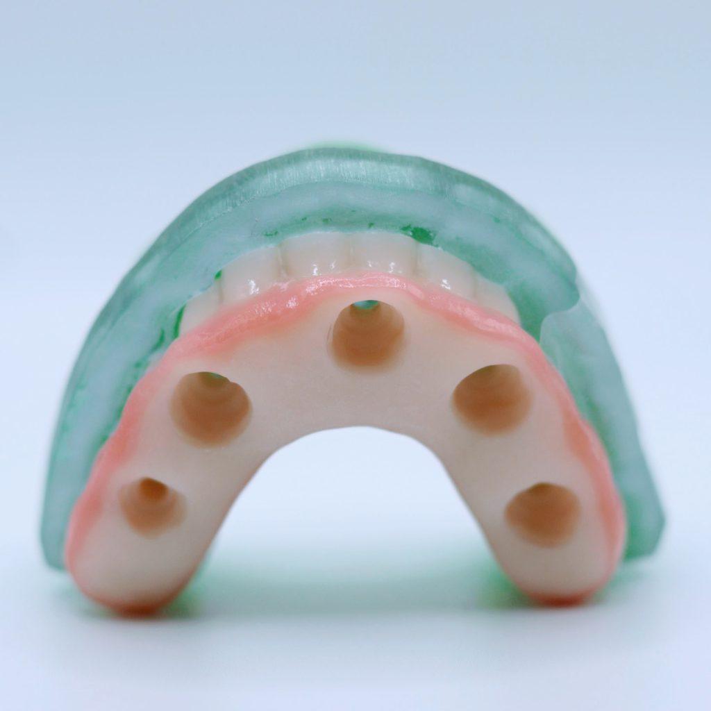 Full Arch Temporary