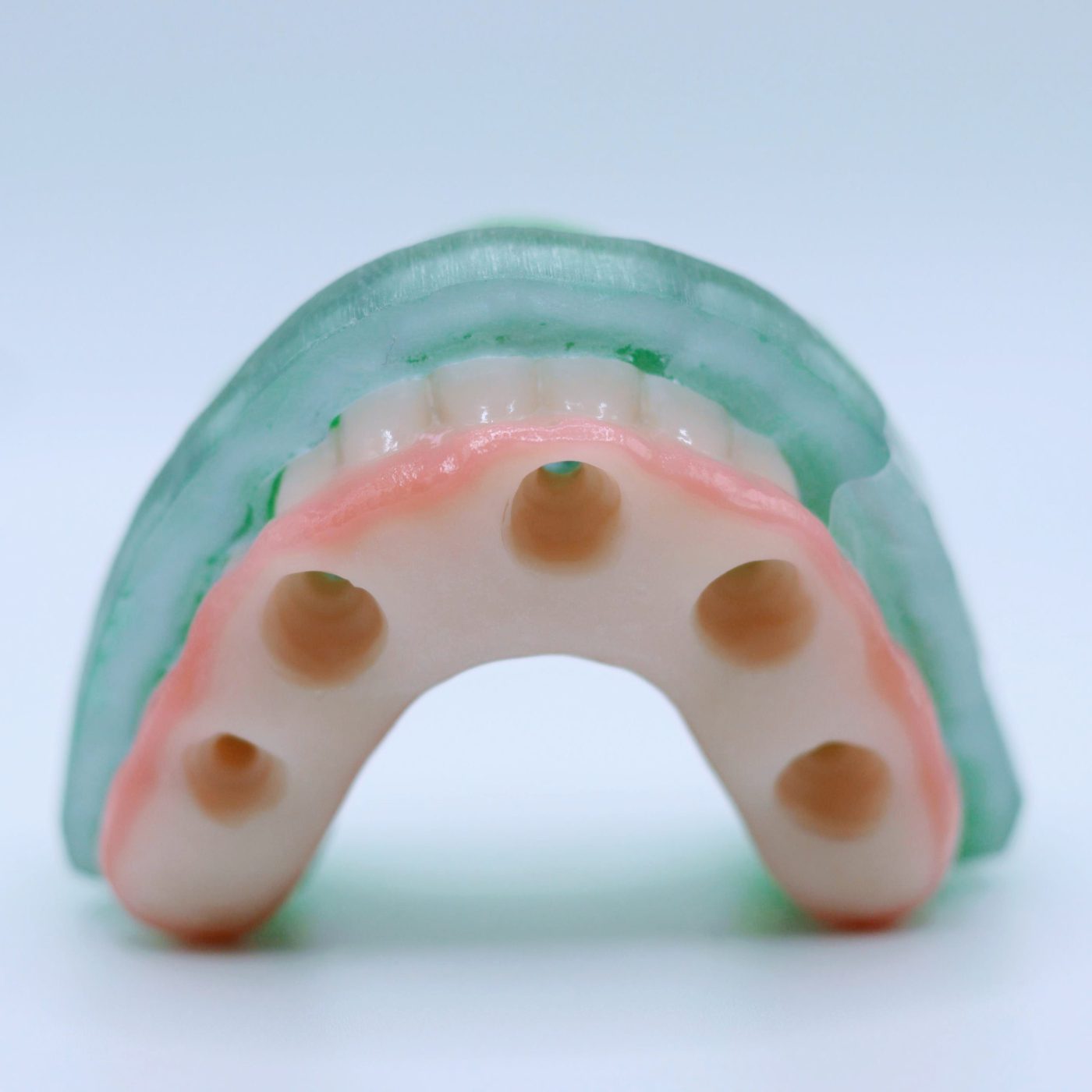 S3 Full Arch - Complete Full Arch Treatment