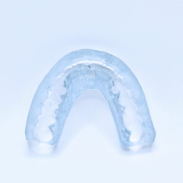 S3 Full Arch - Complete Full Arch Treatment - Image 18
