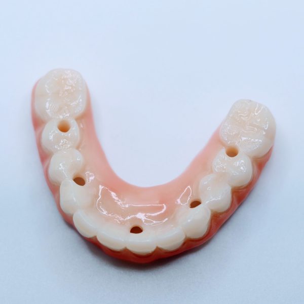 S3 Full Arch - Complete Full Arch Treatment - Image 4