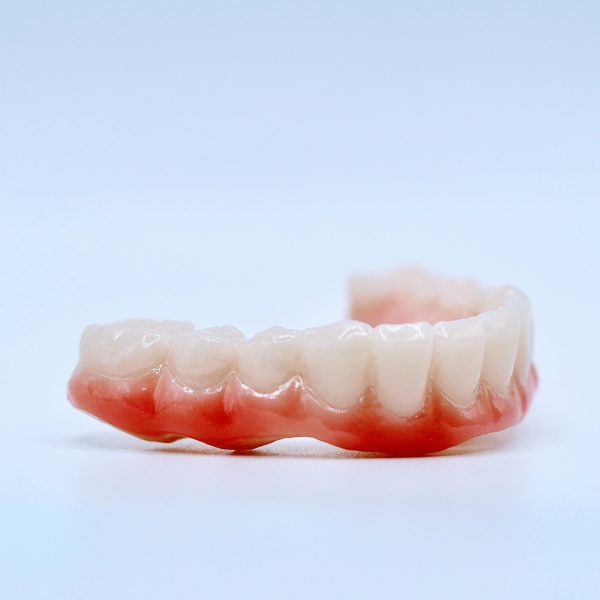 S3 Full Arch - Complete Full Arch Treatment - Image 6