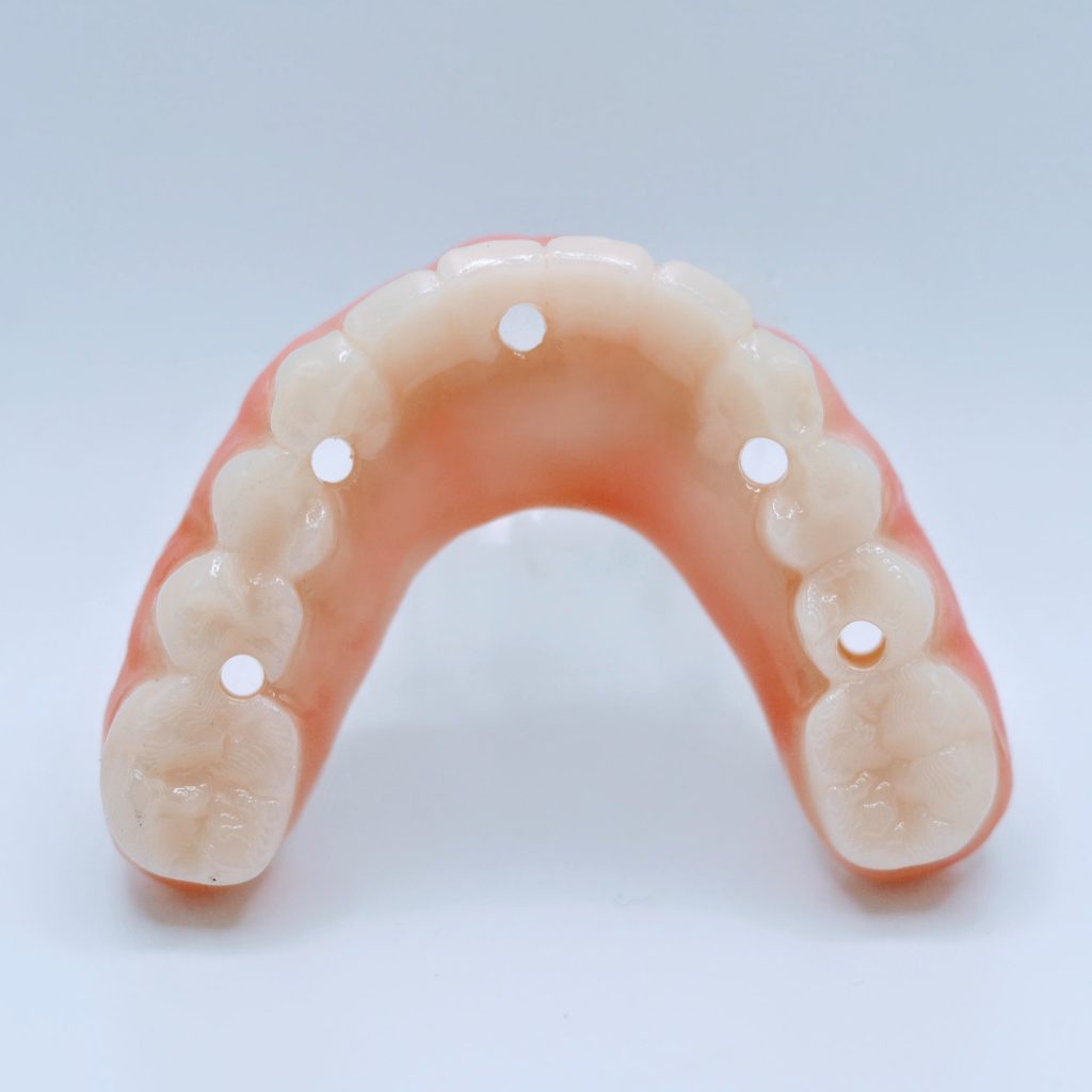 S3 Full Arch - Complete Full Arch Treatment