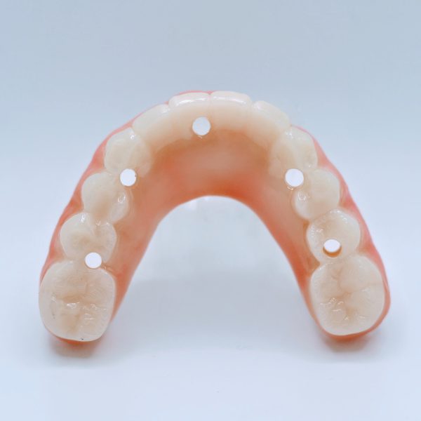S3 Full Arch - Complete Full Arch Treatment - Image 7