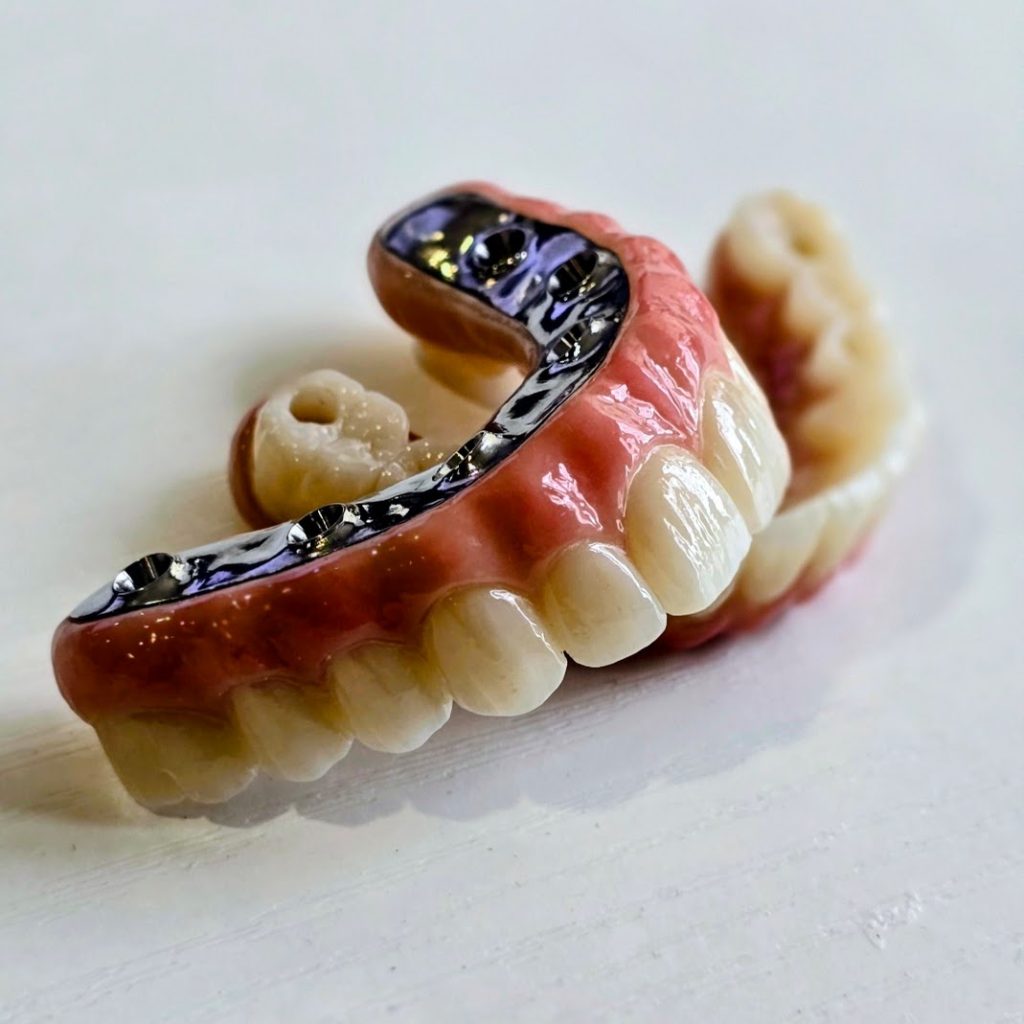 S3 F1 Final Zirconia - ALL-Digital Workflow NO Ti Inserts