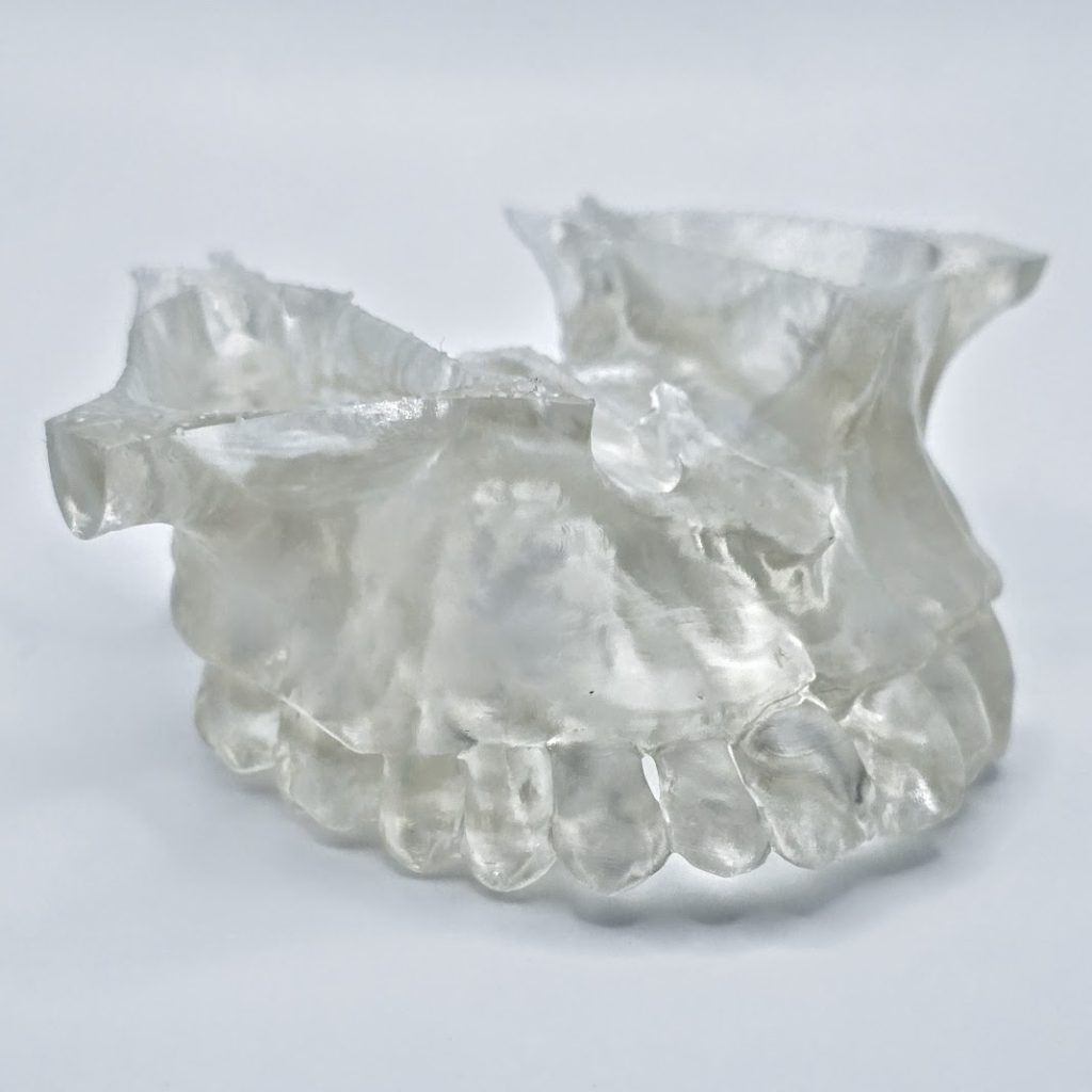 Upper Maxilla Model